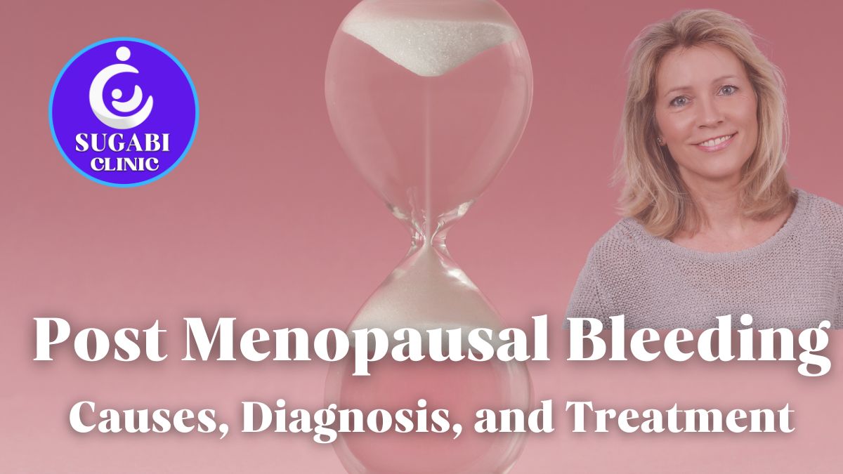 Postmenopausal Bleeding: Causes, Diagnosis & Treatment.